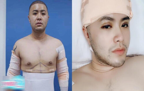 Nam ca sĩ trong cuộc phẫu thuật tốn hơn 300 triệu đồng